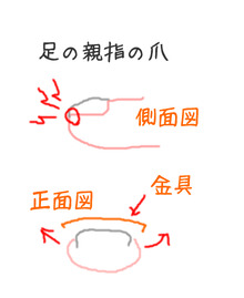 巻き爪の値段