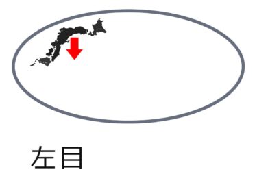 本日の眼底出血